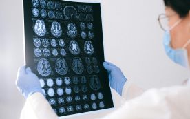 A Doctor Holding an MRI Result of the Brain