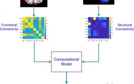 Imaging Reveals Pathways Behind Depression