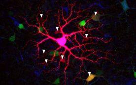 Intrinsically Photosensitive Retinal Ganglion Cell (ipRGC) 